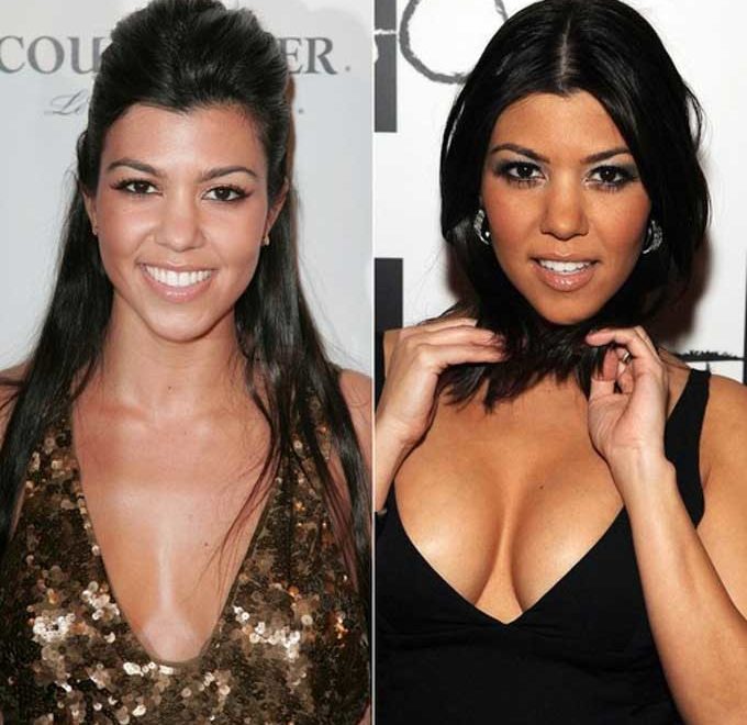 Kourtney Kardashian Plastic Surgery Scandals – Another Fake Beauty of the Kardashians?