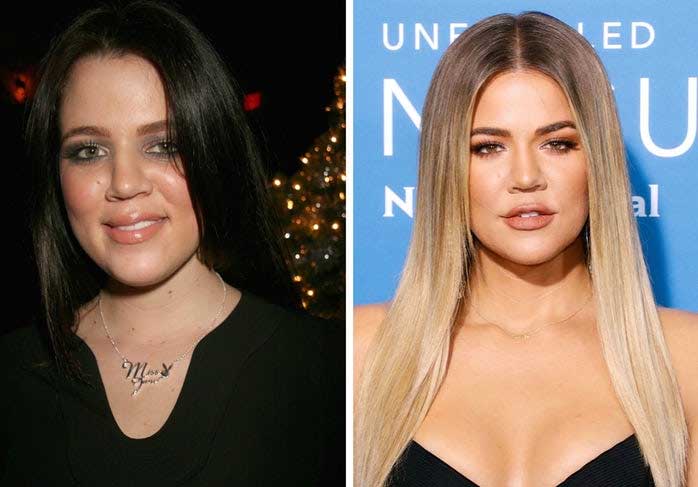 Khloe Kardashian Fabulous Transformation – Adding Another Case Of Kardashian’s Fakest Beauty In The World