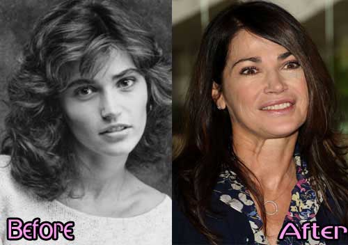 Another Sexy Look at Kim Delaney after Plastic Surgery Scandals