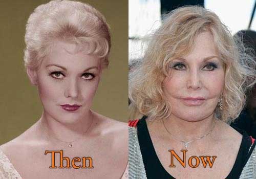 Did Kim Novak Have Plastic Surgery? Look at The Result!